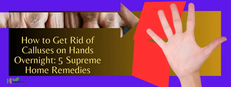 How to Get Rid of Calluses on Hands Overnight 5 Supreme Home Remedies