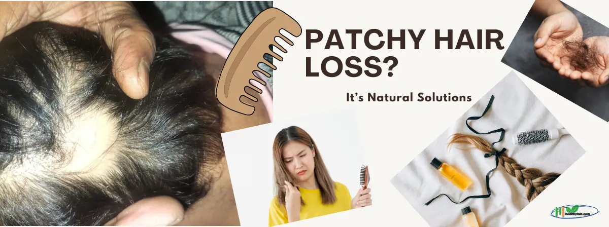 Patchy Hair Loss