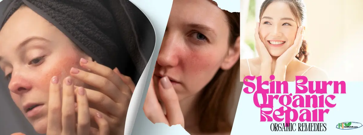 10 Best Organic Remedies for Skin Burn Organic Repair – Heal Naturally!